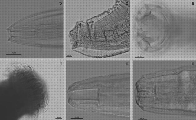 Las mejores marcas de ancylostoma ancylostoma caninum vista microscopio