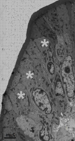 Los 21 Mejores basal microscopios