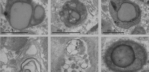 Las mejores marcas de microscopio electrónico célula