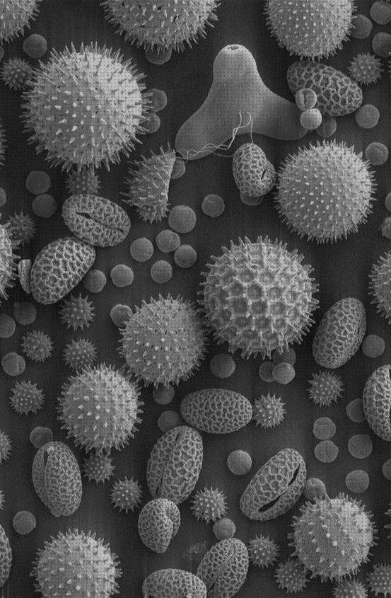 TOP 23 elettronico microscopios