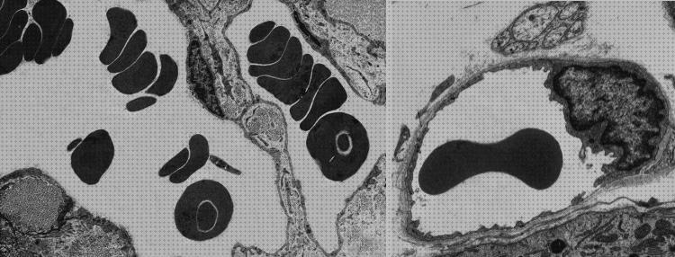 33 Mejores eritrocitos microscopios