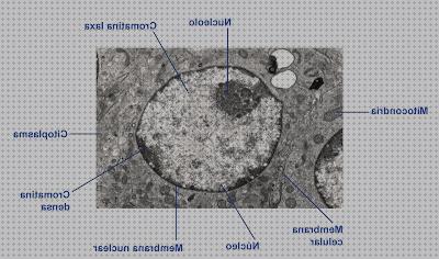 Las mejores marcas de láminas lamina nuclear microscopio electronico