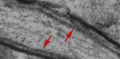 Las mejores láminas lamina nuclear microscopio electronico