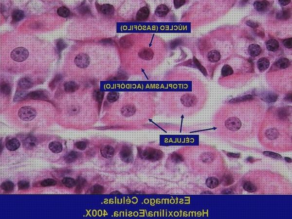 Los mejores 30 Laminarias Microscopios Electrónicos