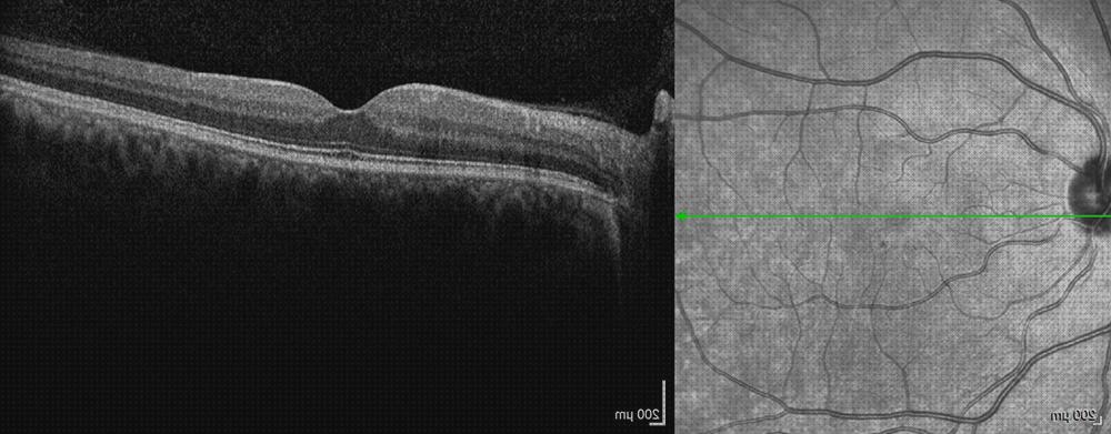 ¿Dónde poder comprar confocal microscopio confocal funcionamento?