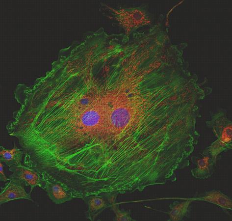 Review de microscopio confocal óptico