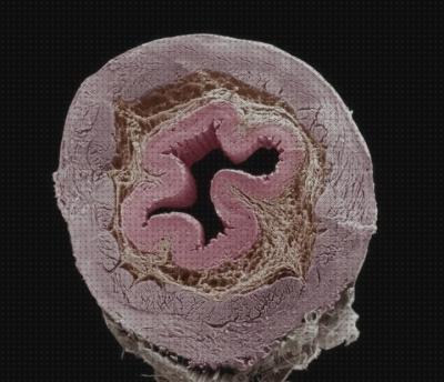 Las mejores microscopio de barrido arterias