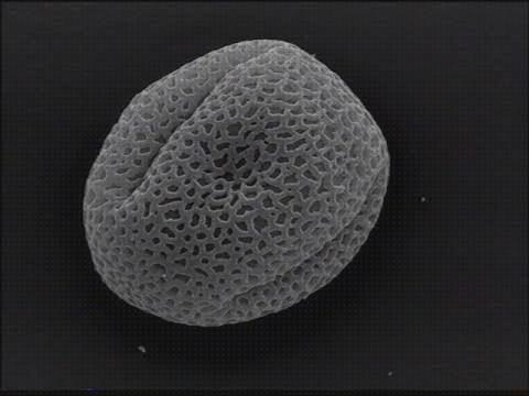 Opiniones de los 30 mejores Microscopios Electronicas De Barridoimagen