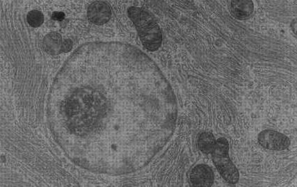 Las mejores microscopio electronico aucariota animal