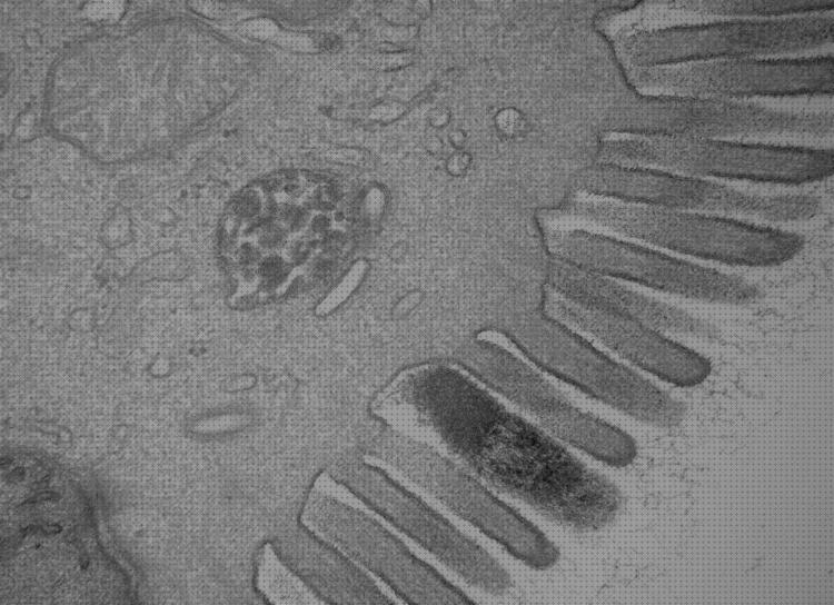 Los 25 Mejores Microscopios Electrónicos Células Alpha