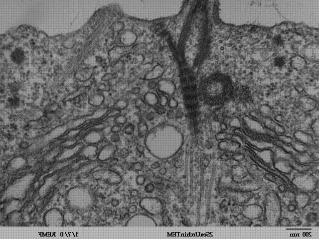 Las mejores marcas de microscopio electronico citoesqueleto