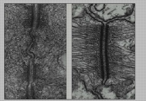 Las mejores microscopio electronico citoesqueleto