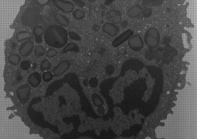 Las mejores electrónicos microscopios microscopio electronico compuesto