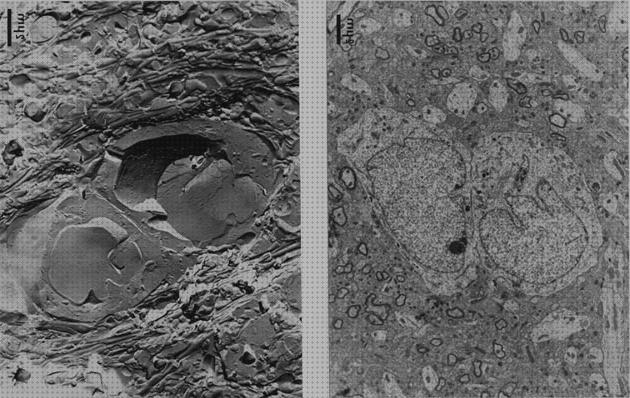 Las mejores microscopio electronico dcelula