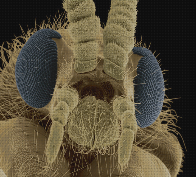 Los 25 Mejores Microscopios Electrónicos De Barridos Insectos