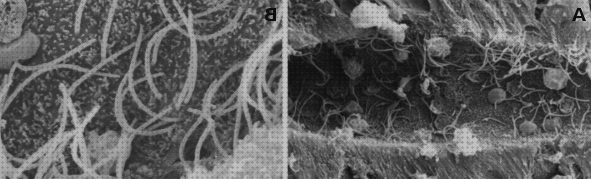 Las mejores mitocondrias microscopio electronico de barrido mitocondrias