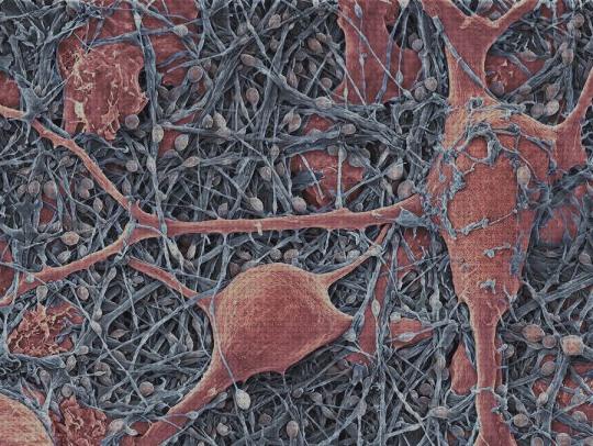 Las mejores microscopio electronico de barrido neurona