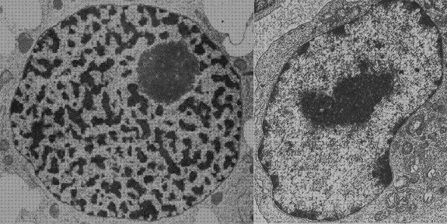 ¿Dónde poder comprar barridos electrónicos microscopios microscopio electronico de barrido nucleo?