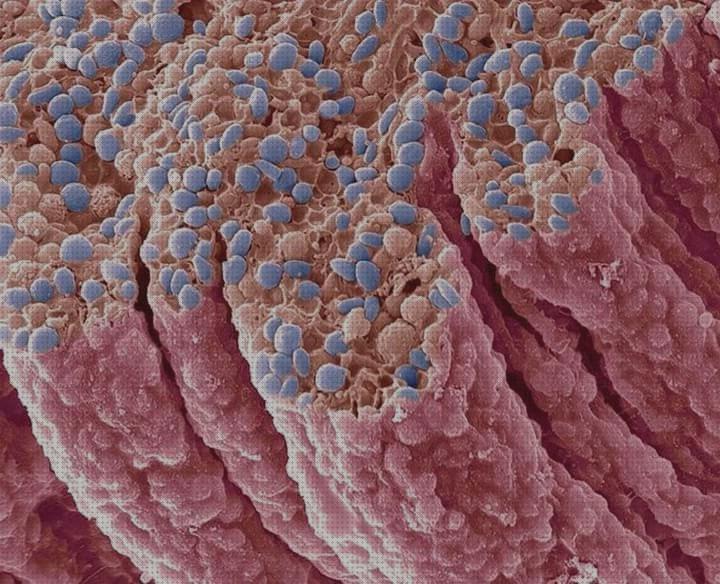 Los mejores 20 Microscopios Electronicos De Barridos Ojos