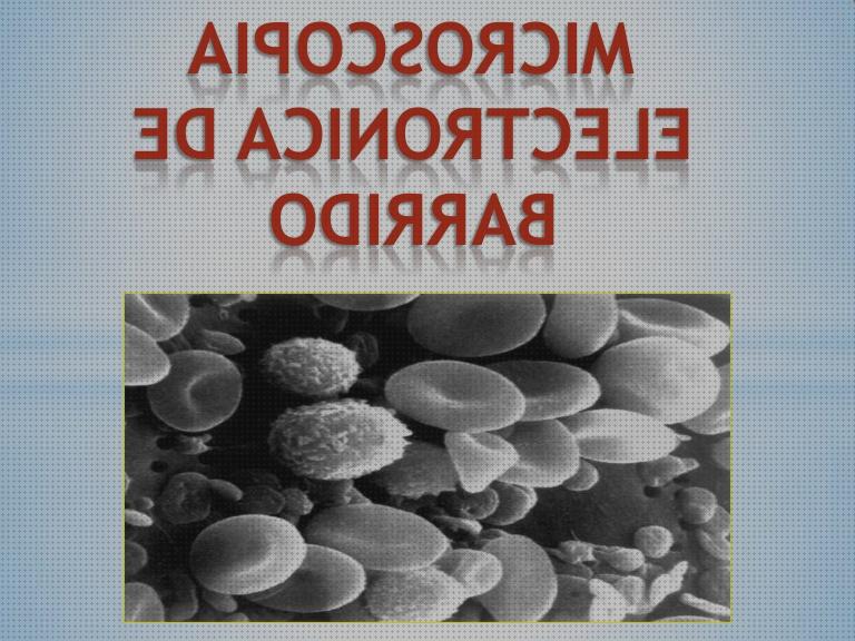 Las mejores marcas de barridos electrónicos microscopios microscopio electronico de barrido resolucion