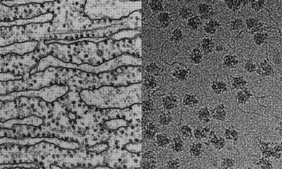 Los mejores 21 Microscopios Electronicos De Barridos Ribosomas