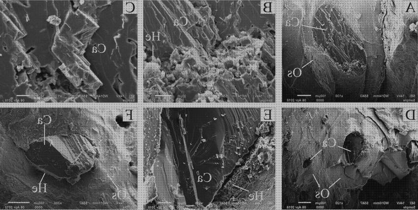 Los 30 Mejores Microscopios Electronicos De Barridos Ull