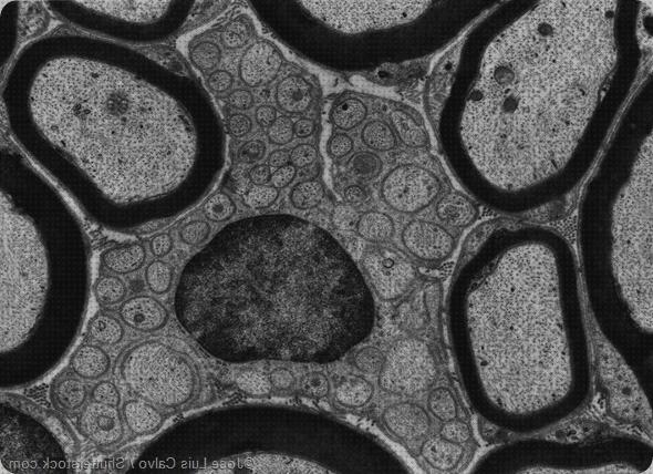 ¿Dónde poder comprar microscopio electronico de transimsson?