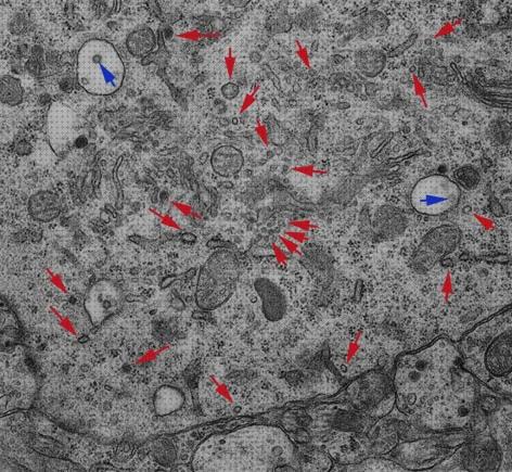 Los 24 Mejores Microscopios Electronicos De Transmision Besiculas