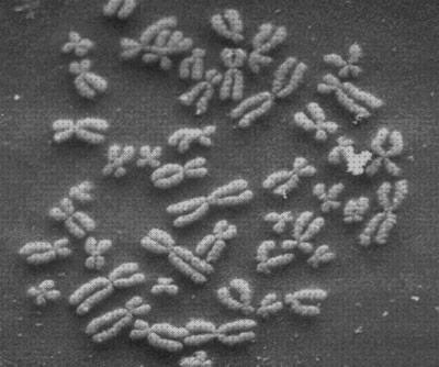 Los mejores 18 Microscopios Electronicos De Transmision Kromosomas