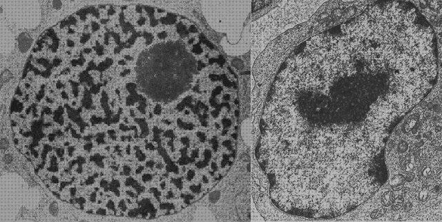 Las mejores microscopio electronico de transmision nucleo