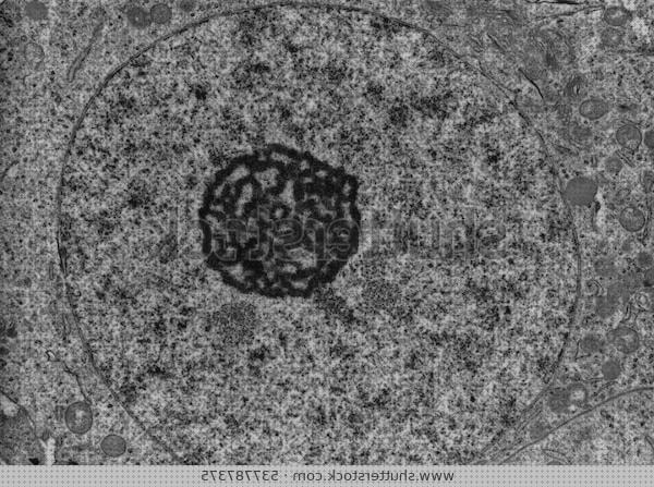 Análisis de los 17 mejores Microscopios Electronicos De Transmision Ultraestructura