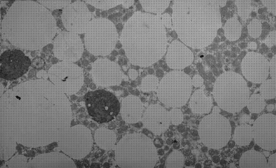 ¿Dónde poder comprar microscopio electronico de transmision vacuola?