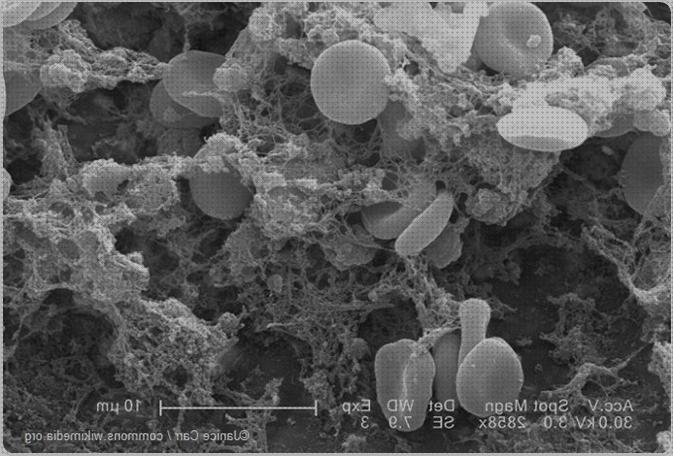 ¿Dónde poder comprar ventajas microscopio electronico de transmision ventajas?