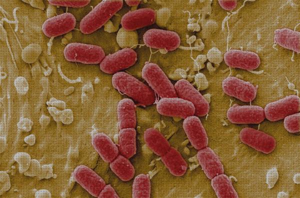 Las mejores marcas de microscopio óptico balantidium coli Más sobre telescopio terrestre reticula Más sobre microscopio electronico poros nucleares microscopio electronico especie e coli