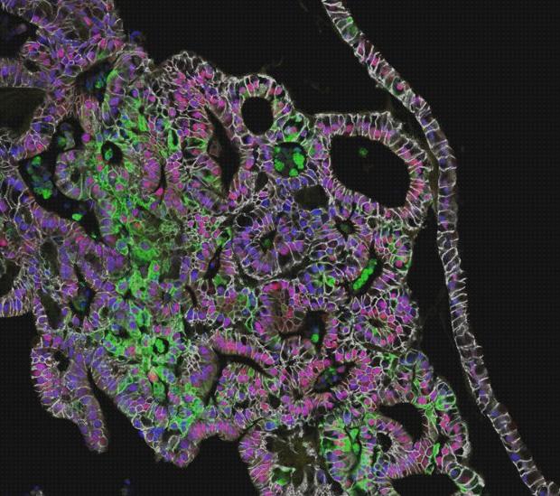 Las mejores microscopio electronico estómago