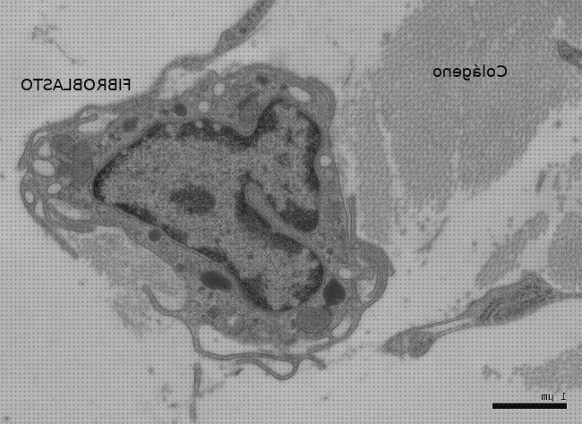 Los 21 Mejores Microscopios Electrónicos Fibrocitos