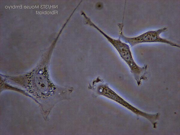 Las mejores marcas de microscopio electrónico fibrocitos