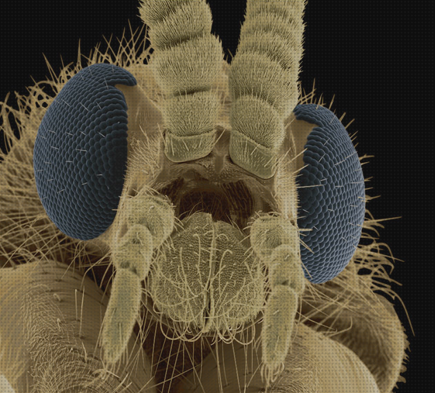 Las mejores microscopio electrónico fondo