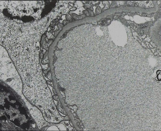 ¿Dónde poder comprar microscopio electronico fusion pedicelar?