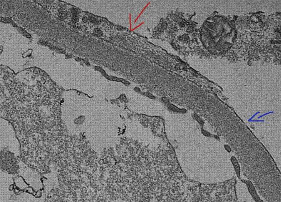 Opiniones de los 24 mejores Microscopios Electronicos Fusiones Pedicelar