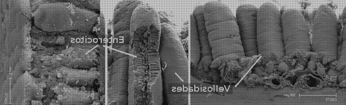 Las mejores microscopio electronico glucocalix