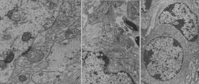 Review de microscopio electronico histologia