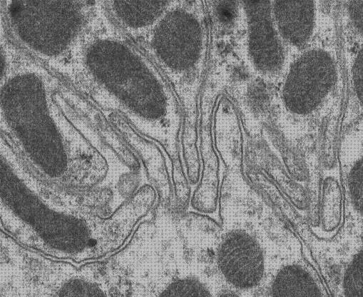 ¿Dónde poder comprar invaginaciones microscopio electronico invaginaciones?