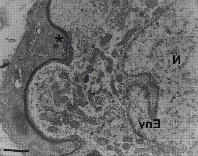 TOP 33 microscopios electronicos invaginaciones a la venta