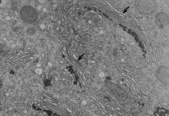 Las mejores invaginaciones microscopio electronico invaginaciones