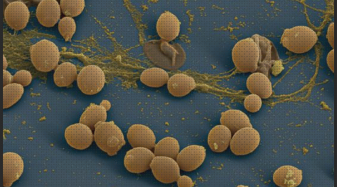 Las mejores microscopio electrónico levaduras