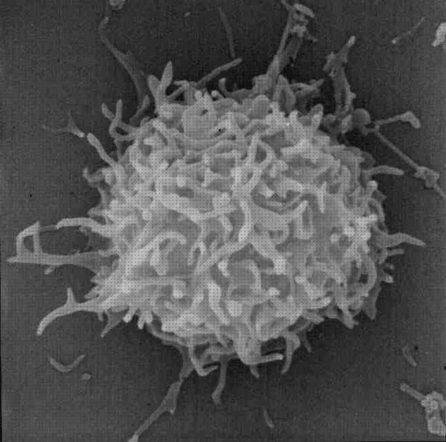 ¿Dónde poder comprar microscopio óptico linfocito Más sobre microscopio electronico mitocondrias Más sobre microscopio stm microscopio electronico linfocito b?