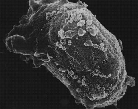 Las mejores marcas de microscopio óptico linfocito Más sobre microscopio electronico mitocondrias Más sobre microscopio stm microscopio electronico linfocito b