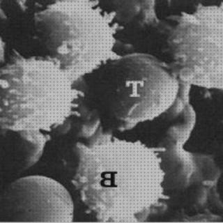 Las mejores microscopio óptico linfocito Más sobre microscopio electronico mitocondrias Más sobre microscopio stm microscopio electronico linfocito t