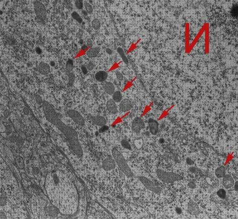 Las mejores microscopio electronico lisosomas